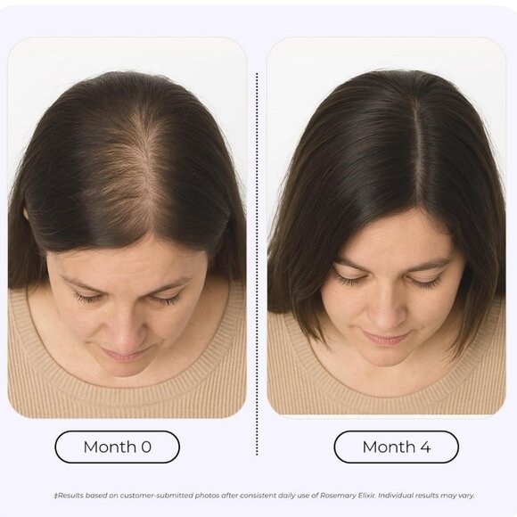 🌿Growplex® Rosemary Elixir™ Hair Oil - Picture 8 of 8